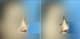 Slider image (5) MISOU Plastic Surgery
